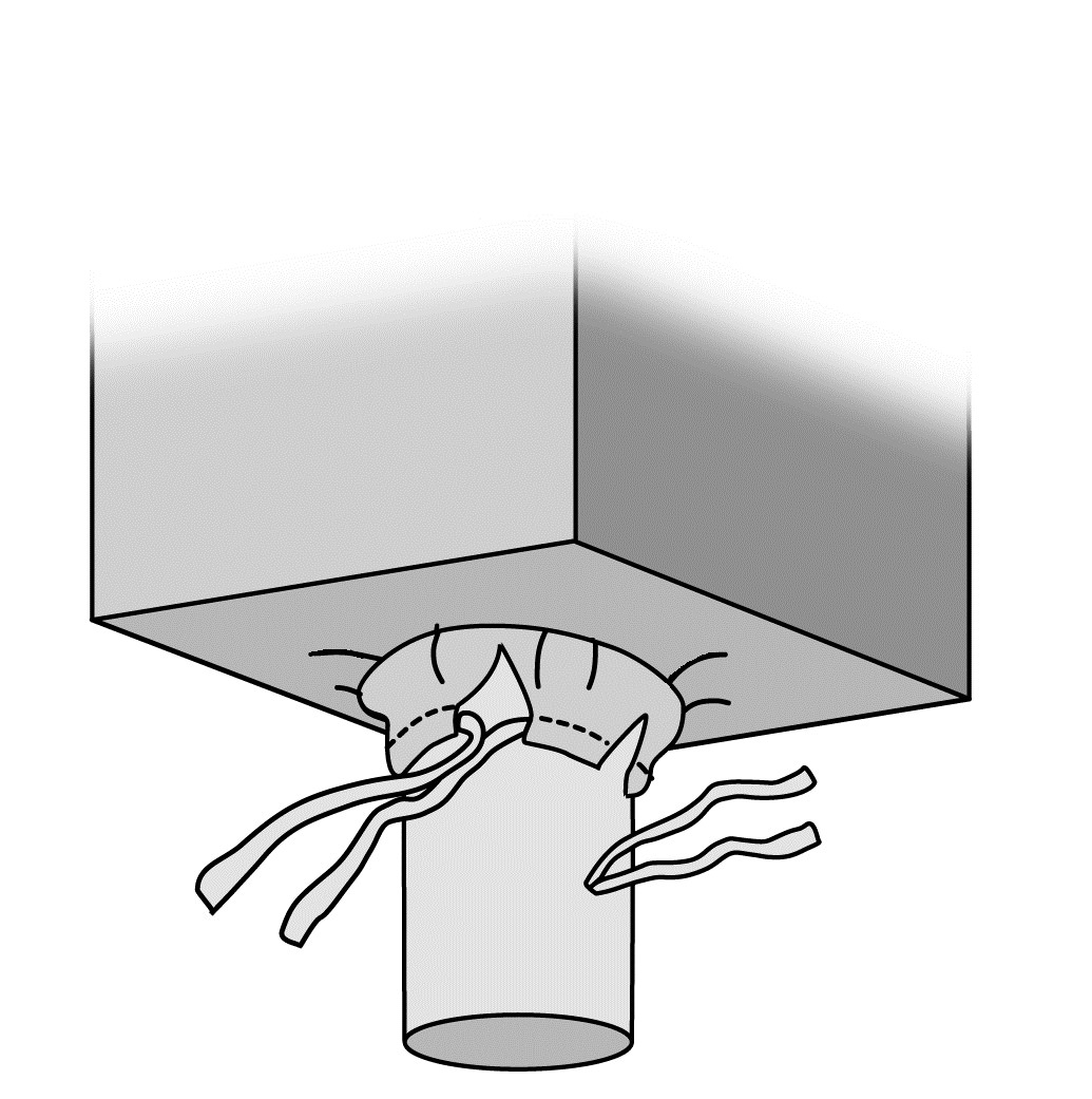 Cheminée de décharge à protection n.